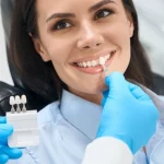 Facette dentaire Rhone Alpes