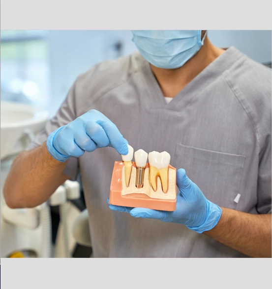 Implant Dentaire Turquie