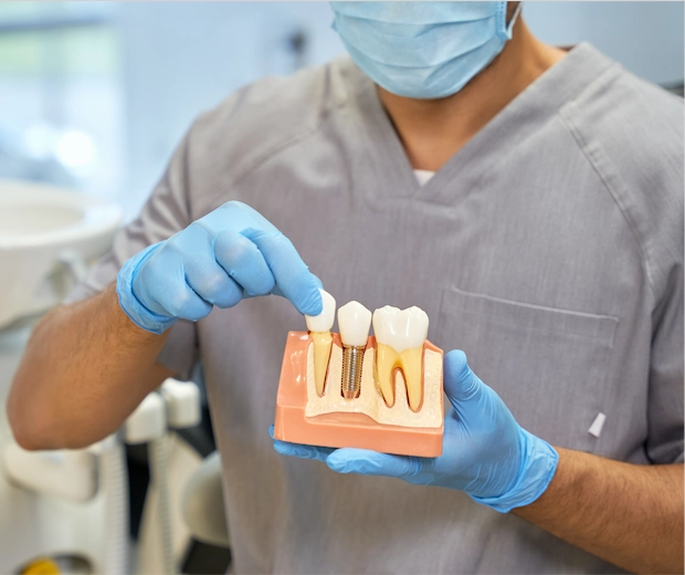 Implant Dentaire pas cher