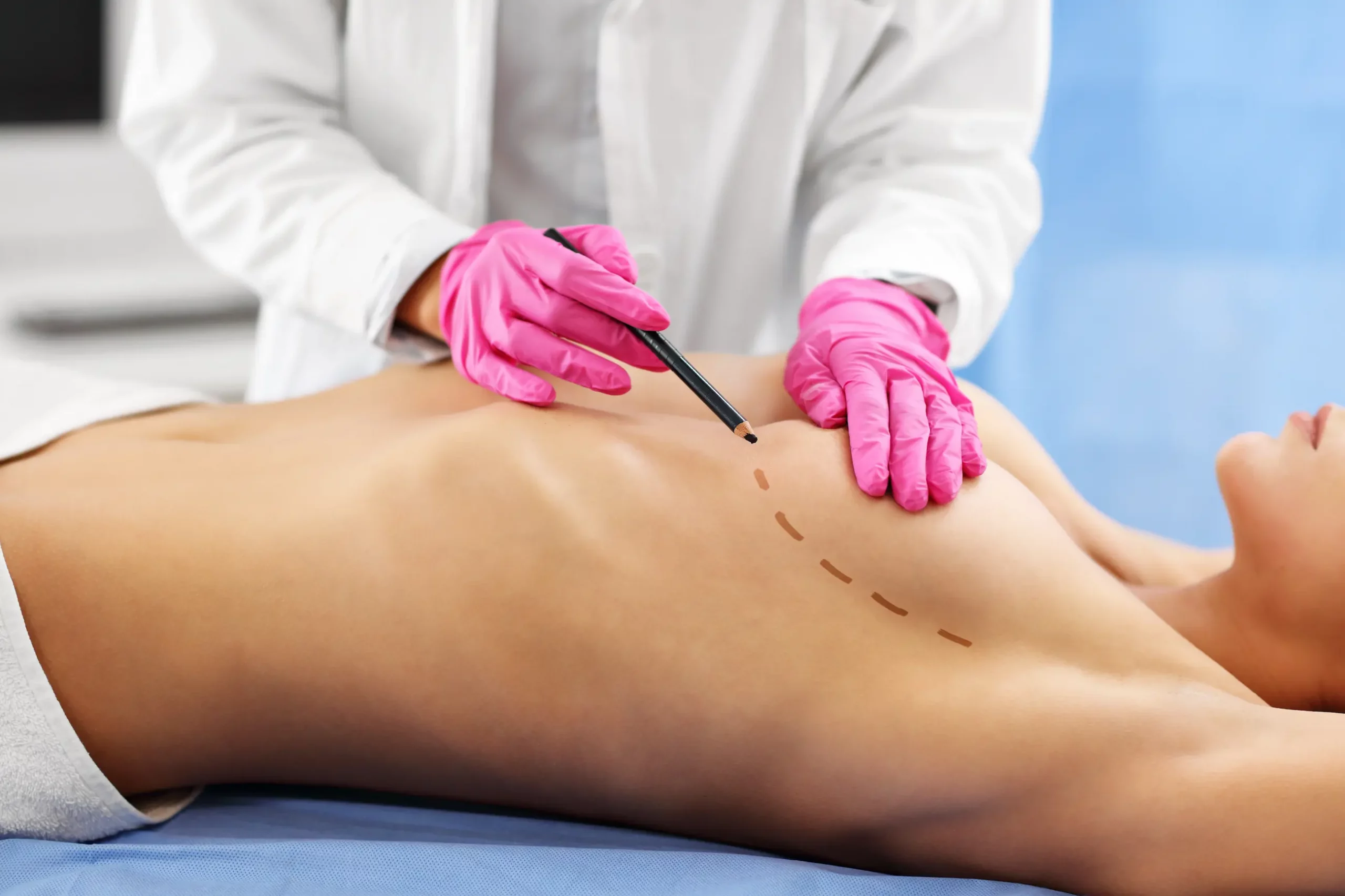 Lipofilling Mammaire Tunisie